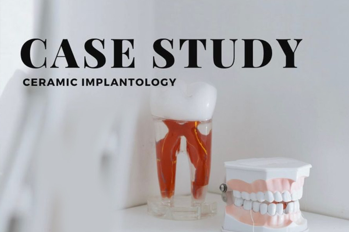 Case study