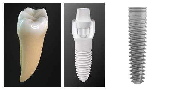 Tooth, ceramic implant and metal implant