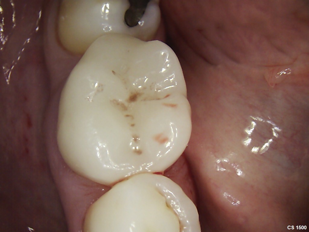 Image0